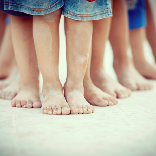 Signs of Flat Feet in Children
